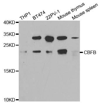 CBFB Antibody - Western blot analysis of extracts of various cell lines.