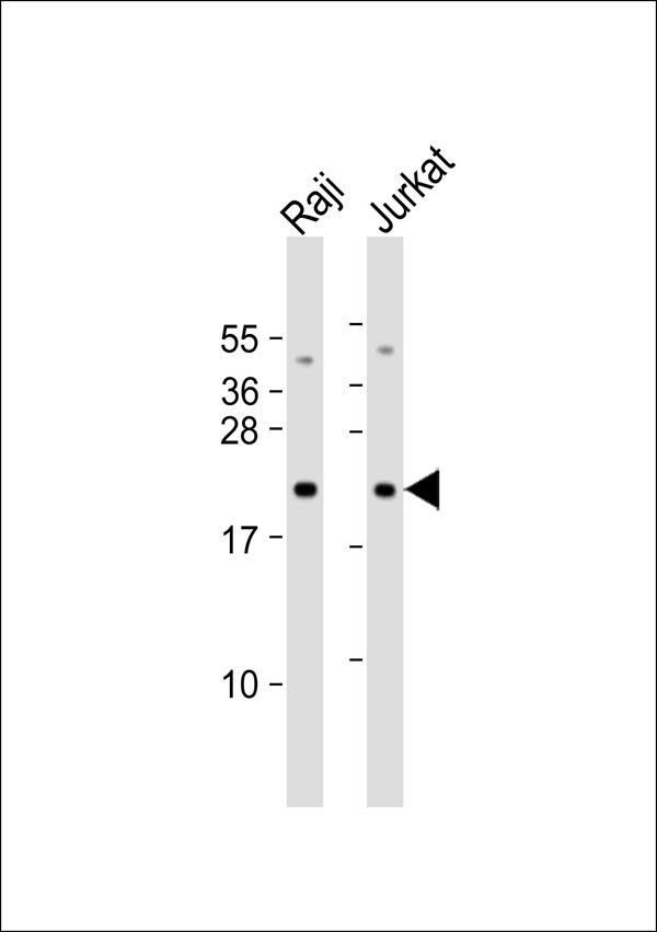 CBFB Antibody - All lanes: Anti-CBFB Antibody at 1:1000 dilution. Lane 1: Raji whole cell lysate. Lane 2: Jurkat whole cell lysate Lysates/proteins at 20 ug per lane. Secondary Goat Anti-Rabbit IgG, (H+L), Peroxidase conjugated at 1:10000 dilution. Predicted band size: 22 kDa. Blocking/Dilution buffer: 5% NFDM/TBST.