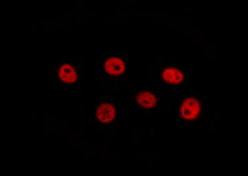 CBFB Antibody - Staining HuvEc cells by IF/ICC. The samples were fixed with PFA and permeabilized in 0.1% Triton X-100, then blocked in 10% serum for 45 min at 25°C. The primary antibody was diluted at 1:200 and incubated with the sample for 1 hour at 37°C. An Alexa Fluor 594 conjugated goat anti-rabbit IgG (H+L) antibody, diluted at 1/600, was used as secondary antibody.