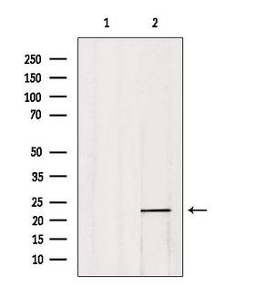 CBFB Antibody - Western blot analysis of extracts of 293 cells using CBF Beta antibody. Lane 1 was treated with the blocking peptide.