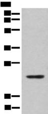 CBFB Antibody - Western blot analysis of Mouse lung tissue lysate  using CBFB Polyclonal Antibody at dilution of 1:400