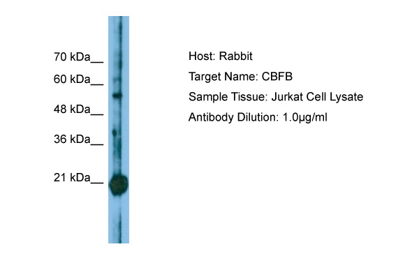 CBFB Antibody -  This image was taken for the unconjugated form of this product. Other forms have not been tested.