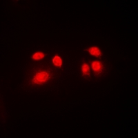 CBFB Antibody - Immunofluorescent analysis of CBFB staining in Jurkat cells. Formalin-fixed cells were permeabilized with 0.1% Triton X-100 in TBS for 5-10 minutes and blocked with 3% BSA-PBS for 30 minutes at room temperature. Cells were probed with the primary antibody in 3% BSA-PBS and incubated overnight at 4 deg C in a humidified chamber. Cells were washed with PBST and incubated with a DyLight 594-conjugated secondary antibody (red) in PBS at room temperature in the dark. DAPI was used to stain the cell nuclei (blue).