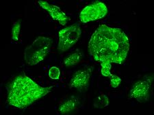 CBFB Antibody - Immunofluorescence staining of CBFB in 293 cells. Cells were fixed with 4% PFA, permeabilzed with 0.3% Triton X-100 in PBS, blocked with 10% serum, and incubated with rabbit anti-Human CBFB polyclonal antibody (dilution ratio 1:300) at 4°C overnight. Then cells were stained with the Alexa Fluor 488-conjugated Goat Anti-rabbit IgG secondary antibody (green). Positive staining was localized to cytoplasm and nucleus.