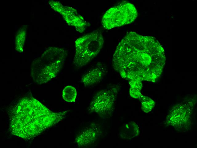 CBFB Antibody - Immunofluorescence staining of CBFB in 293 cells. Cells were fixed with 4% PFA, permeabilzed with 0.3% Triton X-100 in PBS, blocked with 10% serum, and incubated with rabbit anti-Human CBFB polyclonal antibody (dilution ratio 1:300) at 4°C overnight. Then cells were stained with the Alexa Fluor 488-conjugated Goat Anti-rabbit IgG secondary antibody (green). Positive staining was localized to cytoplasm and nucleus.