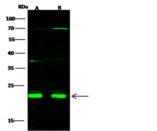 CBFB Antibody - Anti-CBFB rabbit polyclonal antibody at 1:500 dilution. Lane A: Jurkat Whole Cell Lysate. Lane B: K562 Whole Cell Lysate. Lysates/proteins at 30 ug per lane. Secondary: Goat Anti-Rabbit IgG H&L (Dylight 800) at 1/10000 dilution. Developed using the Odyssey technique. Performed under reducing conditions. Predicted band size: 22 kDa. Observed band size: 22 kDa.