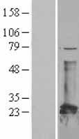 CBFB Protein - Western validation with an anti-DDK antibody * L: Control HEK293 lysate R: Over-expression lysate