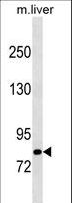 CBLB Antibody - Mouse Cblb Antibody western blot of mouse liver tissue lysates (35 ug/lane). The Cblb antibody detected the Cblb protein (arrow).