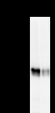 CBLB Antibody - Detection of CBLB by Western blot. Samples: Whole cell lysate from human HeLa (H, 25 ug) and mouse NIH3T3 (M, 25 ug) cells. Predicted molecular weight: 109 kDa