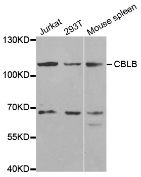 CBLB Antibody - Western blot analysis of extracts of various cell lines, using CBLB antibody.