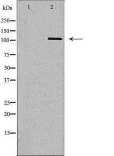 CBLB Antibody - Western blot analysis of extracts of brain tissue using CBLB antibody. The lane on the left is treated with the antigen-specific peptide.
