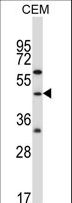 CBLC Antibody - CBLC Antibody (R10) western blot of CEM cell line lysates (35 ug/lane). The CBLC antibody detected the CBLC protein (arrow).