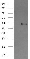 CBLC Antibody - HEK293T cells were transfected with the pCMV6-ENTRY control (Left lane) or pCMV6-ENTRY CBLC (Right lane) cDNA for 48 hrs and lysed. Equivalent amounts of cell lysates (5 ug per lane) were separated by SDS-PAGE and immunoblotted with anti-CBLC.