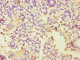 CBLC Antibody - Immunohistochemistry of paraffin-embedded human pancreas tissue using antibody at 1:100 dilution.
