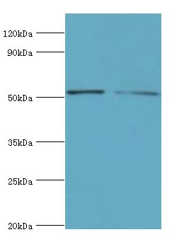 CBLC Antibody - Western blot. All lanes: E3 ubiquitin-protein ligase CBL-C antibody at 14 ug/ml. Lane 1: A549 whole cell lysate. Lane 2: HeLa whole cell lysate. Secondary antibody: Goat polyclonal to rabbit at 1:10000 dilution. Predicted band size: 52 kDa. Observed band size: 52 kDa Immunohistochemistry.