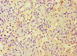 CBLC Antibody - Immunohistochemistry of paraffin-embedded human pancreas tissue using antibody at 1:100 dilution.