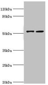 CBLC Antibody - Western blot All lanes: CBLC antibody at 14µg/ml Lane 1: A549 whole cell lysate Lane 2: Hela whole cell lysate Secondary Goat polyclonal to rabbit IgG at 1/10000 dilution Predicted band size: 53, 48 kDa Observed band size: 53 kDa