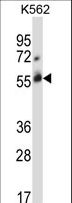 CBLC Antibody - CBLC Antibody (R439) western blot of K562 cell line lysates (35 ug/lane). The CBLC antibody detected the CBLC protein (arrow).