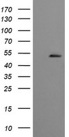 CBLC Antibody - HEK293T cells were transfected with the pCMV6-ENTRY control (Left lane) or pCMV6-ENTRY CBLC (Right lane) cDNA for 48 hrs and lysed. Equivalent amounts of cell lysates (5 ug per lane) were separated by SDS-PAGE and immunoblotted with anti-CBLC.