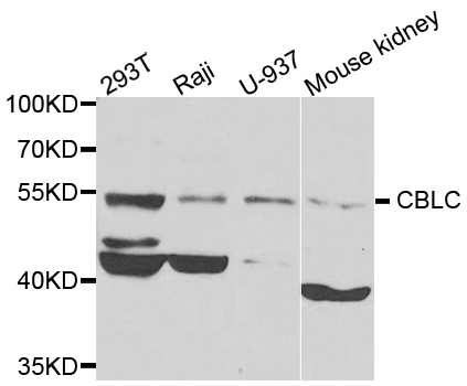 CBLC Antibody - Western blot analysis of extracts of various cells.