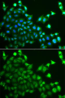 CBLC Antibody - Immunofluorescence analysis of A549 cells.