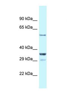 CBLL1 / HAKAI Antibody - CBLL1 antibody Western blot of Mouse Kidney lysate. Antibody concentration 1 ug/ml.  This image was taken for the unconjugated form of this product. Other forms have not been tested.
