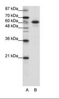 CBLL1 / HAKAI Antibody - A: Marker, B: HepG2 Cell Lysate.  This image was taken for the unconjugated form of this product. Other forms have not been tested.