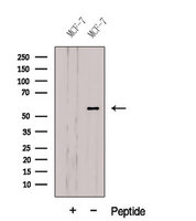 CBLL1 / HAKAI Antibody - Western blot analysis of extracts of MCF-7 cells using CBLL1 antibody. The lane on the left was treated with blocking peptide.