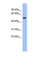CBLL1 / HAKAI Antibody - CBLL1 antibody Western blot of COLO205 cell lysate. This image was taken for the unconjugated form of this product. Other forms have not been tested.