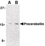 CBLN1 / Cerebellin 1 Antibody - Western blot of precerebellin in 293 cell lysate with Precerebellin Antibody at (A) 2 and (B) 4 ug/ml.
