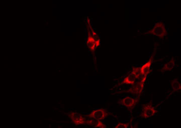 CBLN1 / Cerebellin 1 Antibody - Staining HuvEc cells by IF/ICC. The samples were fixed with PFA and permeabilized in 0.1% Triton X-100, then blocked in 10% serum for 45 min at 25°C. The primary antibody was diluted at 1:200 and incubated with the sample for 1 hour at 37°C. An Alexa Fluor 594 conjugated goat anti-rabbit IgG (H+L) Ab, diluted at 1/600, was used as the secondary antibody.