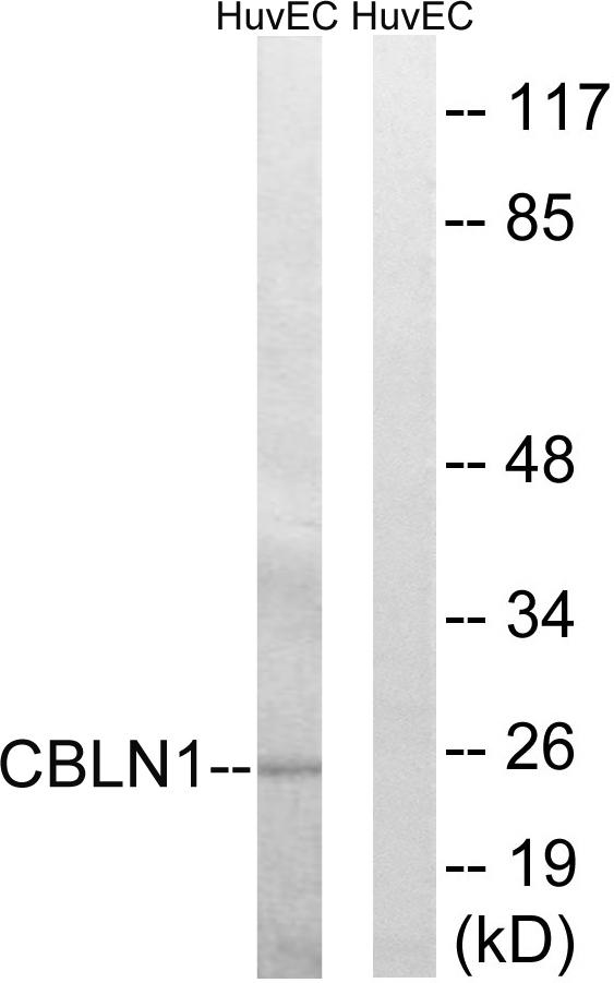 CBLN1 / Cerebellin 1 Antibody - Western blot analysis of extracts from HUVEC cells, using CBLN1 antibody.