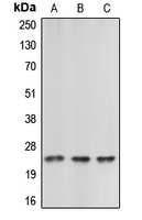 CBLN2 / Cerebellin 2 Antibody - Western blot analysis of Cerebellin 2 expression in HEK293T (A); Raw264.7 (B); rat kidney (C) whole cell lysates.