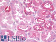 CBLN3 / Cerebellin 3 Antibody - Human Kidney: Formalin-Fixed, Paraffin-Embedded (FFPE)