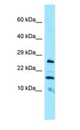 CBLN3 / Cerebellin 3 Antibody - CBLN3 / Cerebellin 3 antibody Western Blot of HepG2.  This image was taken for the unconjugated form of this product. Other forms have not been tested.
