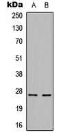 CBLN3 / Cerebellin 3 Antibody - Western blot analysis of Cerebellin 3 expression in HepG2 (A); mouse brain (B) whole cell lysates.