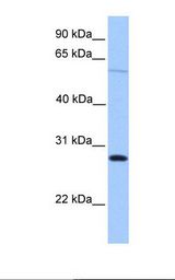 CBLN4 / Cerebellin 4 Antibody - Hela cell lysate. Antibody concentration: 1.0 ug/ml. Gel concentration: 12%.  This image was taken for the unconjugated form of this product. Other forms have not been tested.