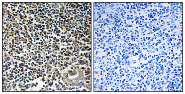 CBLN4 / Cerebellin 4 Antibody - Immunohistochemistry analysis of paraffin-embedded human thymus gland tissue, using CBLN4 Antibody. The picture on the right is blocked with the synthesized peptide.