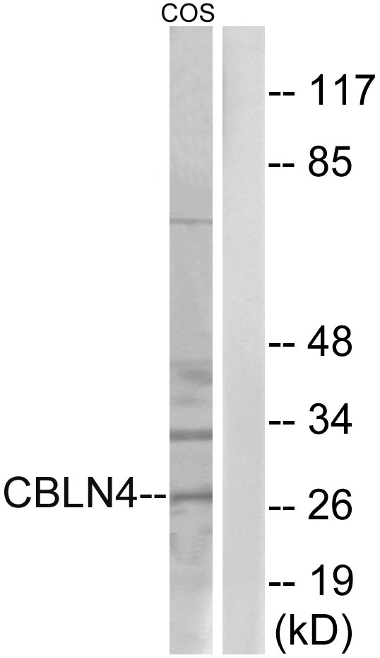 CBLN4 / Cerebellin 4 Antibody - Western blot analysis of lysates from COS cells, using CBLN4 Antibody. The lane on the right is blocked with the synthesized peptide.