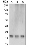 CBLN4 / Cerebellin 4 Antibody - Western blot analysis of Cerebellin 4 expression in HEK293T (A); SP2/0 (B); rat liver (C) whole cell lysates.
