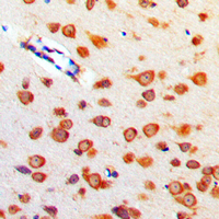 CBLN4 / Cerebellin 4 Antibody - Immunohistochemical analysis of Cerebellin 4 staining in human brain formalin fixed paraffin embedded tissue section. The section was pre-treated using heat mediated antigen retrieval with sodium citrate buffer (pH 6.0). The section was then incubated with the antibody at room temperature and detected using an HRP conjugated compact polymer system. DAB was used as the chromogen. The section was then counterstained with hematoxylin and mounted with DPX.