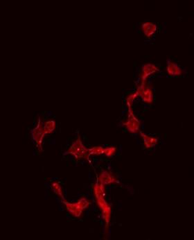 CBLN4 / Cerebellin 4 Antibody - Staining HeLa cells by IF/ICC. The samples were fixed with PFA and permeabilized in 0.1% Triton X-100, then blocked in 10% serum for 45 min at 25°C. The primary antibody was diluted at 1:200 and incubated with the sample for 1 hour at 37°C. An Alexa Fluor 594 conjugated goat anti-rabbit IgG (H+L) Ab, diluted at 1/600, was used as the secondary antibody.