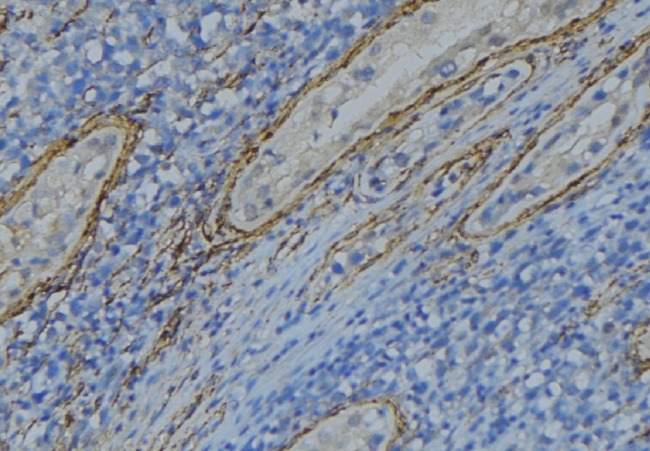 CBLN4 / Cerebellin 4 Antibody - 1:100 staining human uterus tissue by IHC-P. The sample was formaldehyde fixed and a heat mediated antigen retrieval step in citrate buffer was performed. The sample was then blocked and incubated with the antibody for 1.5 hours at 22°C. An HRP conjugated goat anti-rabbit antibody was used as the secondary.