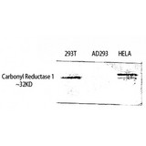 CBR / CBR1 Antibody - Western blot of Carbonyl Reductase 1 antibody