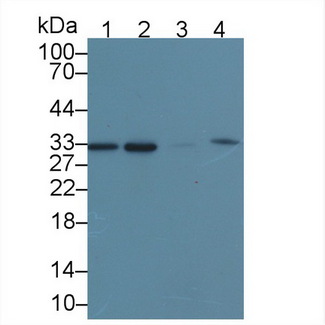 CBR / CBR1 Antibody - Western Blot; Sample: Recombinant protein.