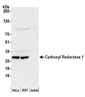 CBR / CBR1 Antibody - Detection of human Carbonyl Reductase 1 by western blot. Samples: Whole cell lysate (50 µg) from HeLa, HEK293T, and Jurkat cells prepared using NETN lysis buffer. Antibody: Affinity purified rabbit anti-Carbonyl Reductase 1 antibody used for WB at 0.1 µg/ml. Detection: Chemiluminescence with an exposure time of 10 seconds.