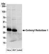 CBR / CBR1 Antibody - Detection of human Carbonyl Reductase 1/CBR1 by western blot. Samples: Whole cell lysate (50 µg) from HeLa, HEK293T, and Jurkat cells prepared using NETN lysis buffer. Antibody: Affinity purified rabbit anti-Carbonyl Reductase 1/CBR1 antibody used for WB at 0.1 µg/ml. Detection: Chemiluminescence with an exposure time of 3 seconds.