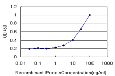 CBR / CBR1 Antibody - Detection limit for recombinant GST tagged CBR1 is approximately 1 ng/ml as a capture antibody.