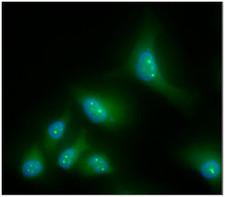 CBR / CBR1 Antibody - ICC/IF analysis of CBR1 in HeLa cells line, stained with DAPI (Blue) for nucleus staining and monoclonal anti-human CBR1 antibody (1:100) with goat anti-mouse IgG-Alexa fluor 488 conjugate (Green).