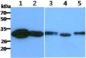 CBR / CBR1 Antibody - The Recombinant Human CBR1 (50ng) and Cell lysates (40ug) were resolved by SDS-PAGE, transferred to PVDF membrane and probed with anti-human CBR1 antibody (1:1000). Proteins were visualized using a goat anti-mouse secondary antibody conjugated to HRP and an ECL detection system. Lane 1.: Recombinant Human CBR1 Lane 2. : HeLa cell lysate Lane 3. : 293T cell lysate Lane 4. : MCF-7 cell lysate Lane 5. : HepG2 cell lysate